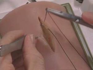 Subcuticular Suturing Model 9005